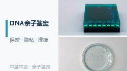 北京亲子鉴定医院地址在哪里，北京医院办理亲子鉴定要怎么做